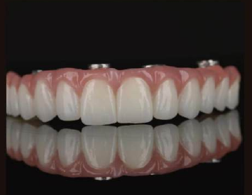Caso clínico con zirconia DentalStock