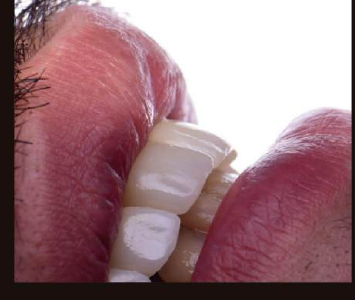 Caso clínico con zirconia DentalStock